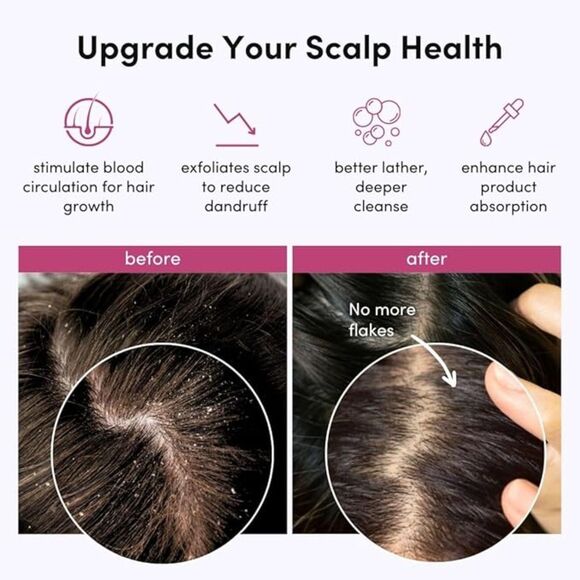 Fancii Hair Scalp Massager, Shampoo Brush for Wet & Dry Hair, Scalp Scrubber - Picture 3 of 5